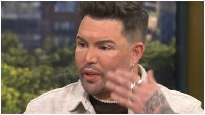 Bobby Norris reveals ‘life-threatening’ health scare led to dramatic face and neck lift: ‘Tomorrow isn’t guaranteed’