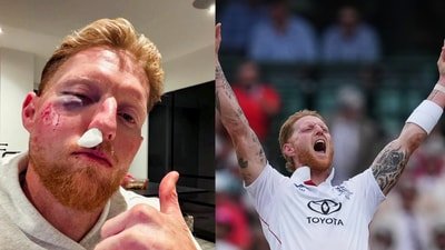 Ben Stokes suffered a facial fracture in February. (AP)