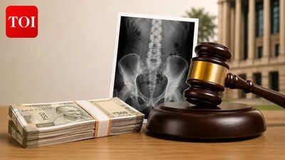 AI generated image Rs 1 lakh awarded to patient who underwent two kidney stone surgeries but got no relief