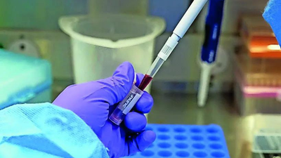 Representative image India tightens screening after 2 suspected Ebola cases surface
