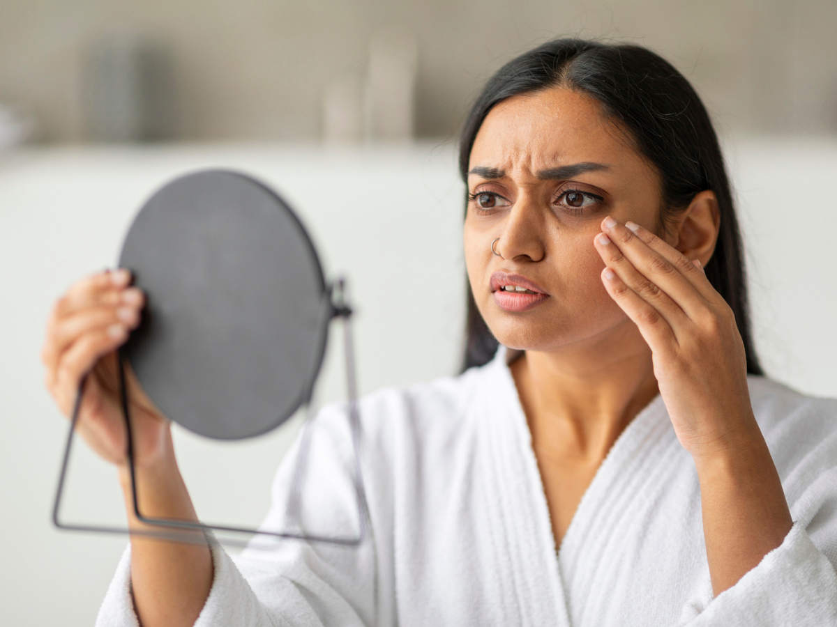 Why Your Expensive Creams Aren’t Working for Pigmentation But Lasers Might​
