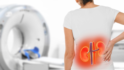 She replaced regular meals with concentrated vegetable juices to lose weight; Three months later, she developed acute kidney injury