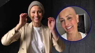 Melanie Sykes reveals her bald look, following the diagnosis of Alopecia: 'Loss + Gain = Life'