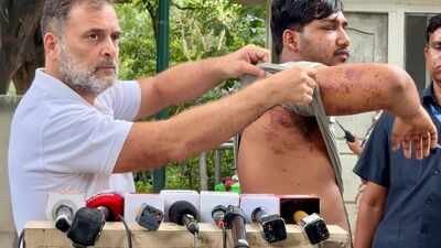 Rahul Gandhi brings alleged pellet gun victim before media (Image/X) 'His eye suffered damage': Rahul Gandhi brings alleged pellet gun victim before media, renews call to sack Pradhan