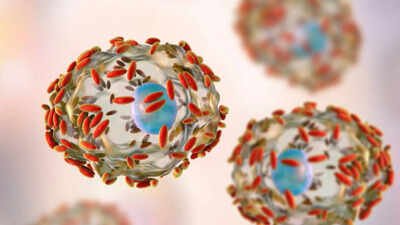 Explosive stomach infection hits US, how the parasite Cyclospora makes people unwell and what researchers know so far about its source