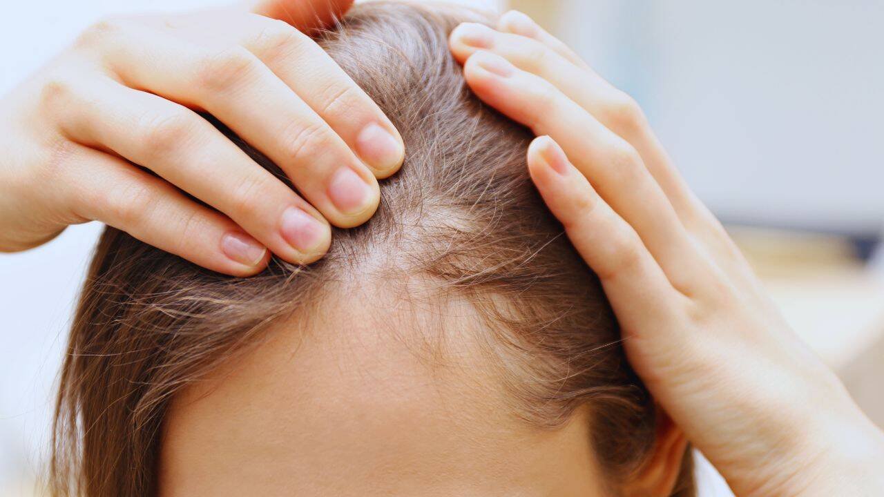 Many other things are required for a healthy hair