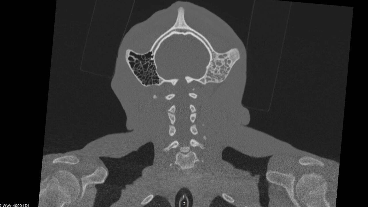 Mizani's CT scan