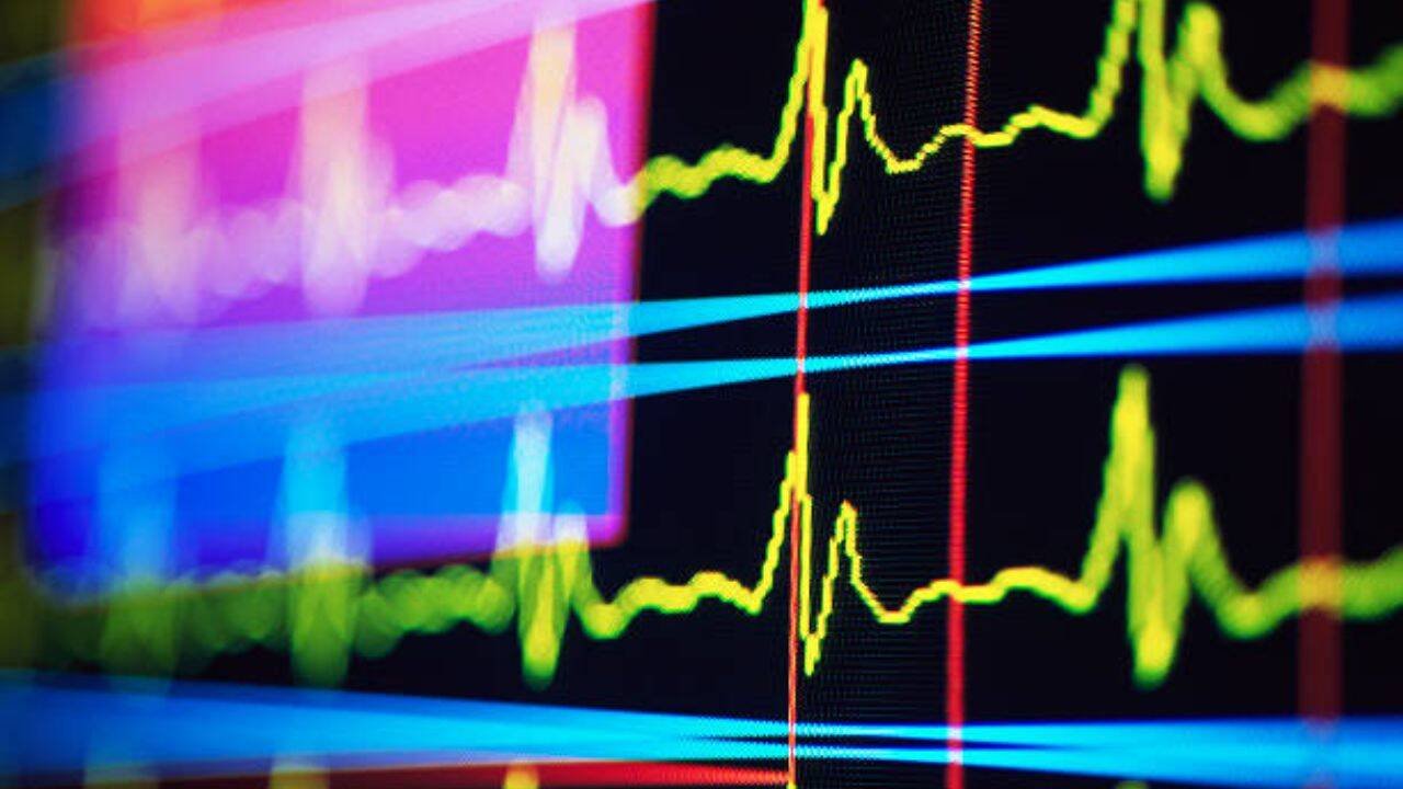 Npy+ neurons control heart rate<br><br>