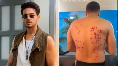 Gaurav Khanna suffers back injury while participating in Khatron Ke Khiladi 15. Gaurav Khanna suffers back injury while participating in Khatron Ke Khiladi 15.