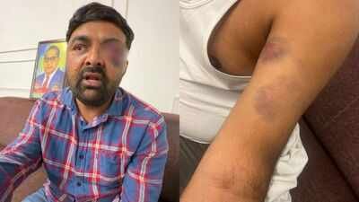 Bhati alleged that SOG personnel subjected them to repeated beatings, casteist slurs and degrading treatment, and kept them in custody for close to 12 hours. Meerut custody torture: SSP, 8 cops face action, ADG orders probe