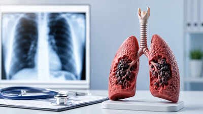 Lung cancer is increasingly affecting non-smokers and young people in India (AI-generated image used for representational purposes) More non-smokers, youth detected with lung cancer