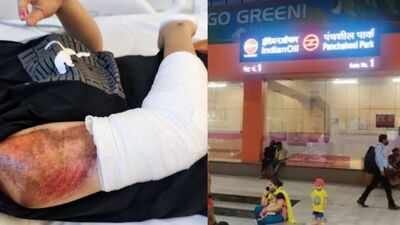 A 21-year-old woman reported being stalked and harassed by two men on a motorcycle in South Delhi 'Stalked, hit deliberately': Delhi woman scooterist claims bikers chased her before crash near Panchsheel Metro Station