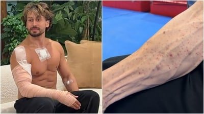 Tiger Shroff's team's video seemed to explain his bandages in first pictures after the firing. Tiger Shroff's team's video seemed to explain his bandages in first pictures after the firing.