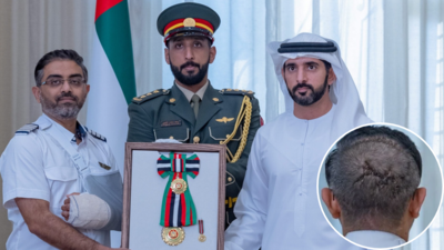 'Battle scars': Massive stitches on Captain Smit Machchhar head draw attention as UAE honours hero Indian pilot