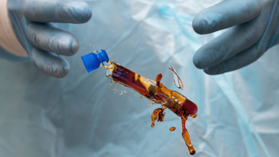 Representational image Plague in Siberia: Lab worker, 28, dies after reported test-tube accident; nearly 200 contacts under observation