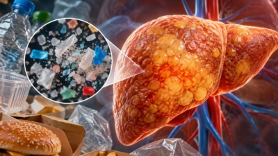 Researchers found that polyethylene microplastics worsened signs of fatty liver, especially when combined with an unhealthy diet, raising questions about a plastic used in everyday packaging