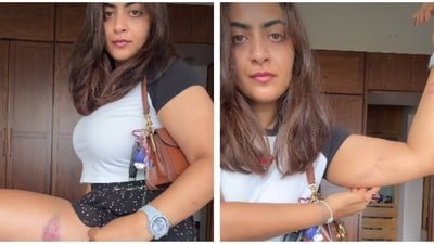 Zayn Marie showed marks on her body a day after the detention. Zayn Marie showed marks on her body a day after the detention.